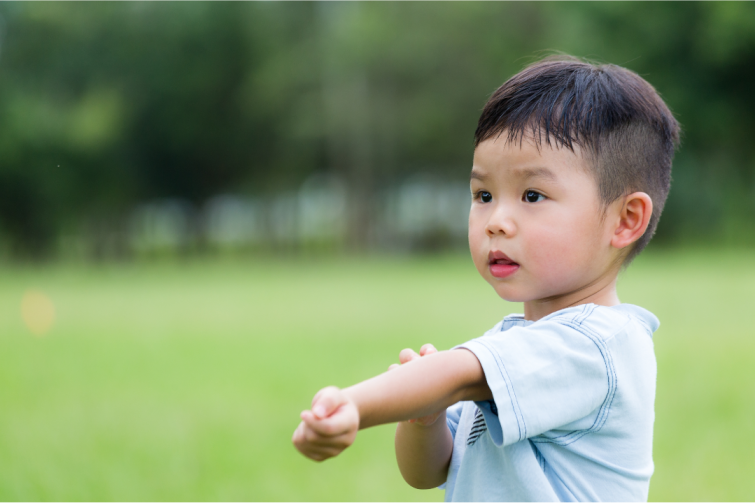 Child with psoriasis