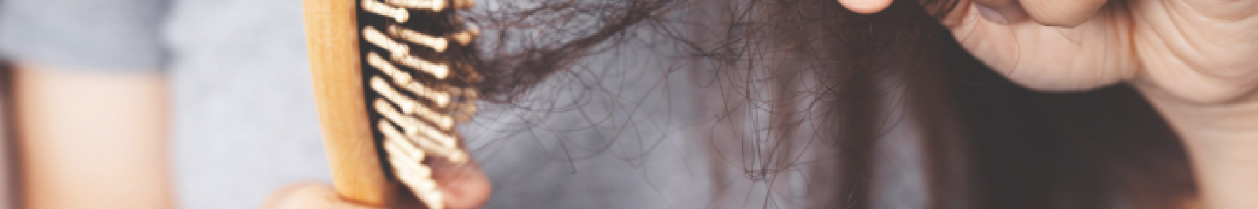 Hair Matters: Emotional Aspects of Hair Loss - Dermatology